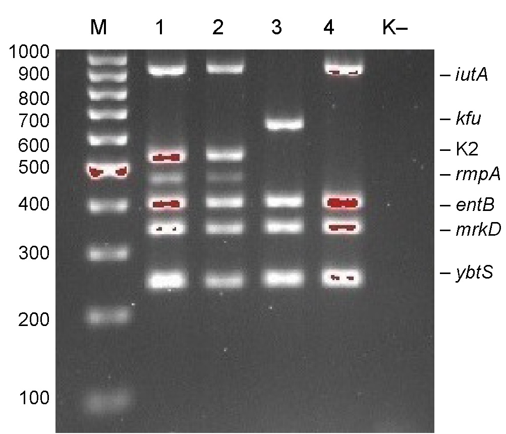 Antimicrobial resistance and virulence of carbapenem-resistant <i>Klebsiella pneumoniae</i> strains isolated from children in intensive care and surgical units