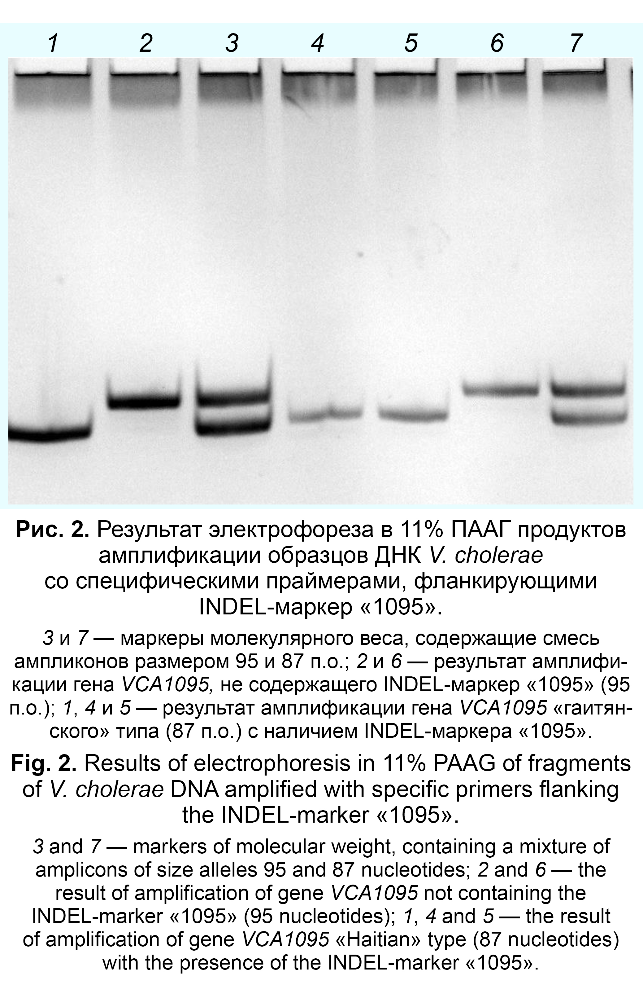Identification of Vibrio cholerae Strains of the «Haitian» Group by PCR Based on INDEL-Typing